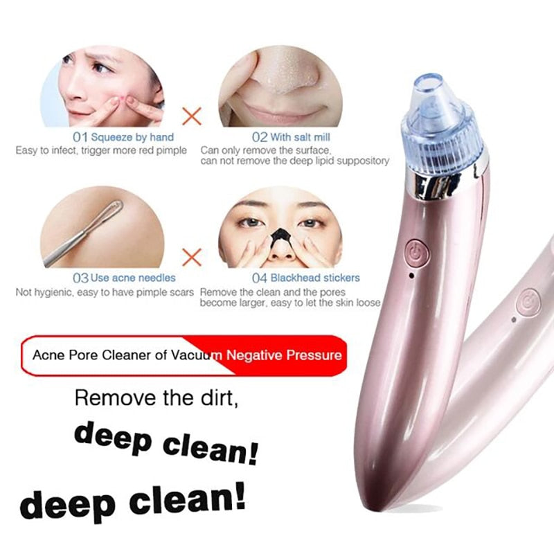 Multifunctional Beauty Pore Vacuum