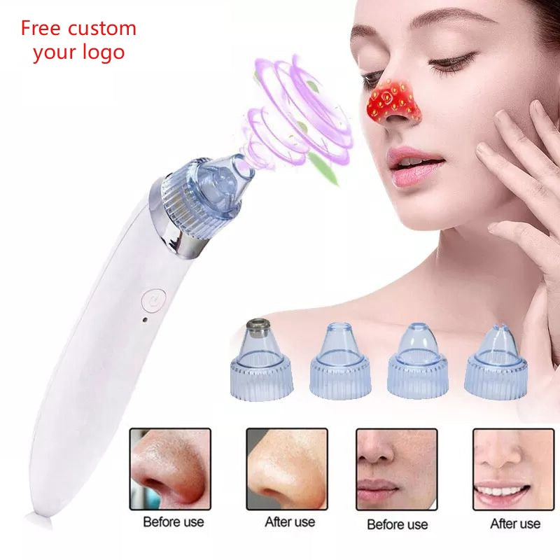 Multifunctional Beauty Pore Vacuum